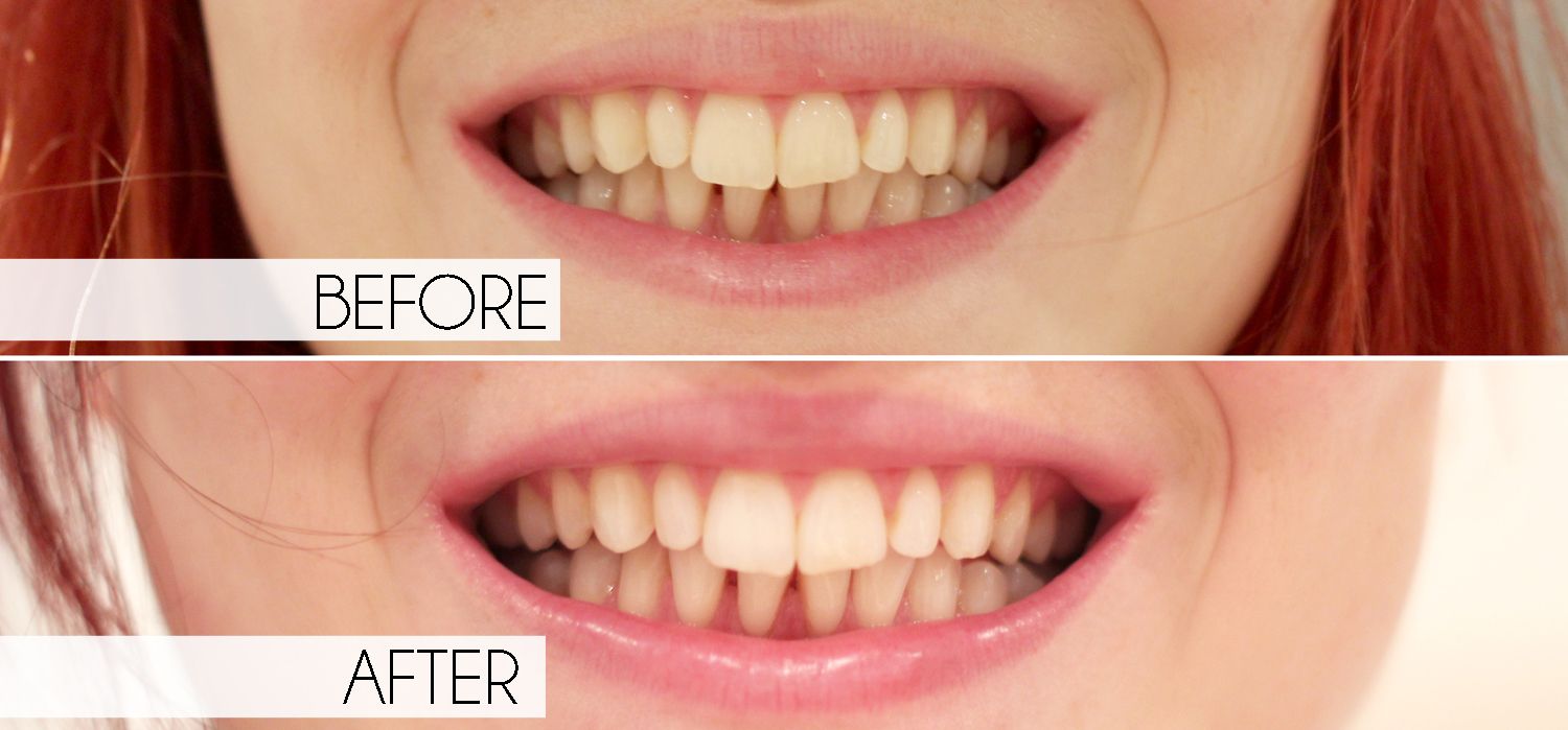 photo paige joanna minty coco before and after_zps0y22kovd.jpg