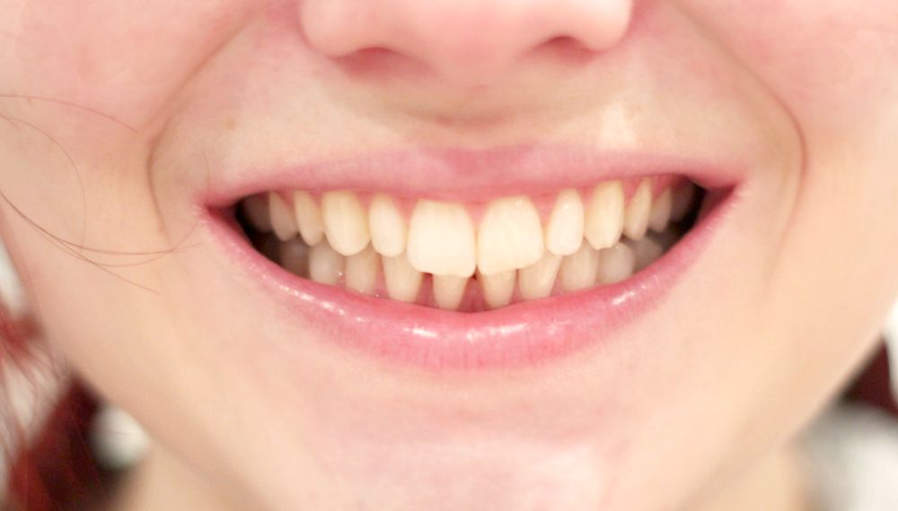 photo paige joanna minty coco whitening_zpsgq7z7tdg.jpg