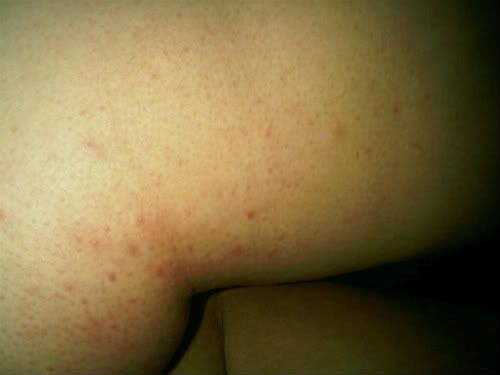 Before Using Spray